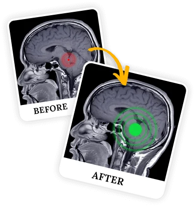 How Does the Billionaire Brain Wave Program Work?